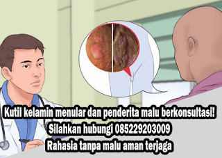 Obat Kutil Kelamin