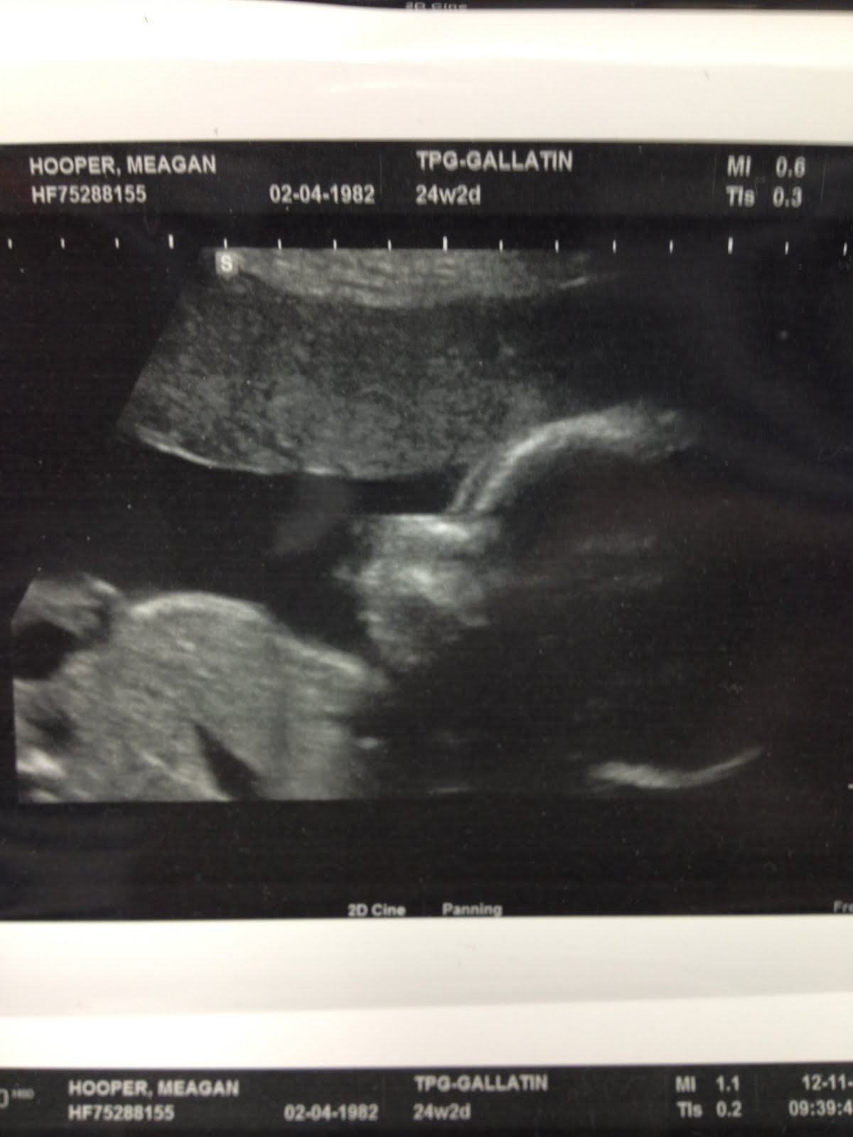 Ty's 20 week ultrasound