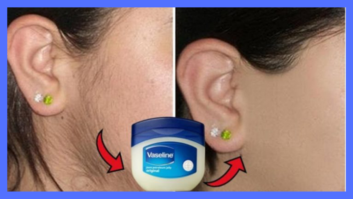 A Simple Vaseline Trick To Remove Unwanted Hair On The Body… healhty