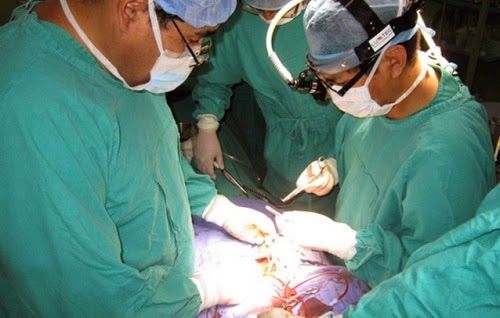 operacion
