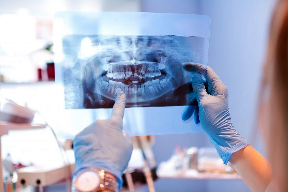 Radiografia Dental