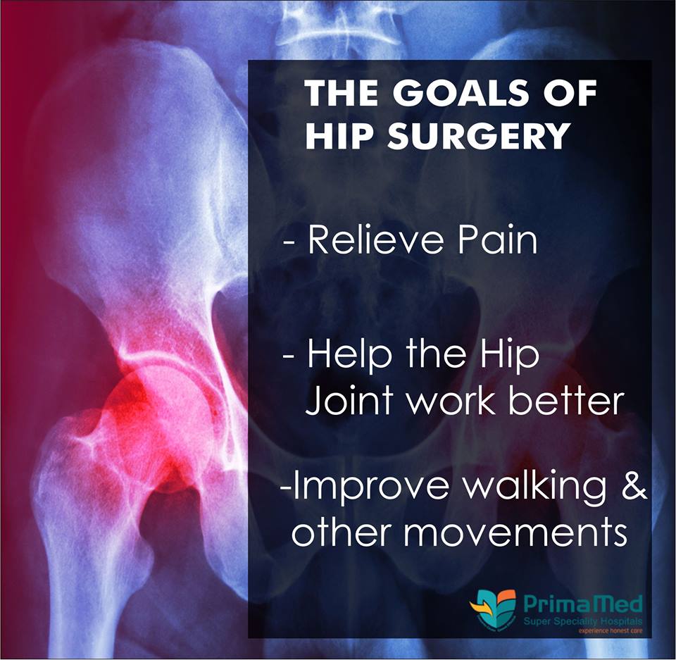 Primamed Hospitals Gives You Best hip Replacement