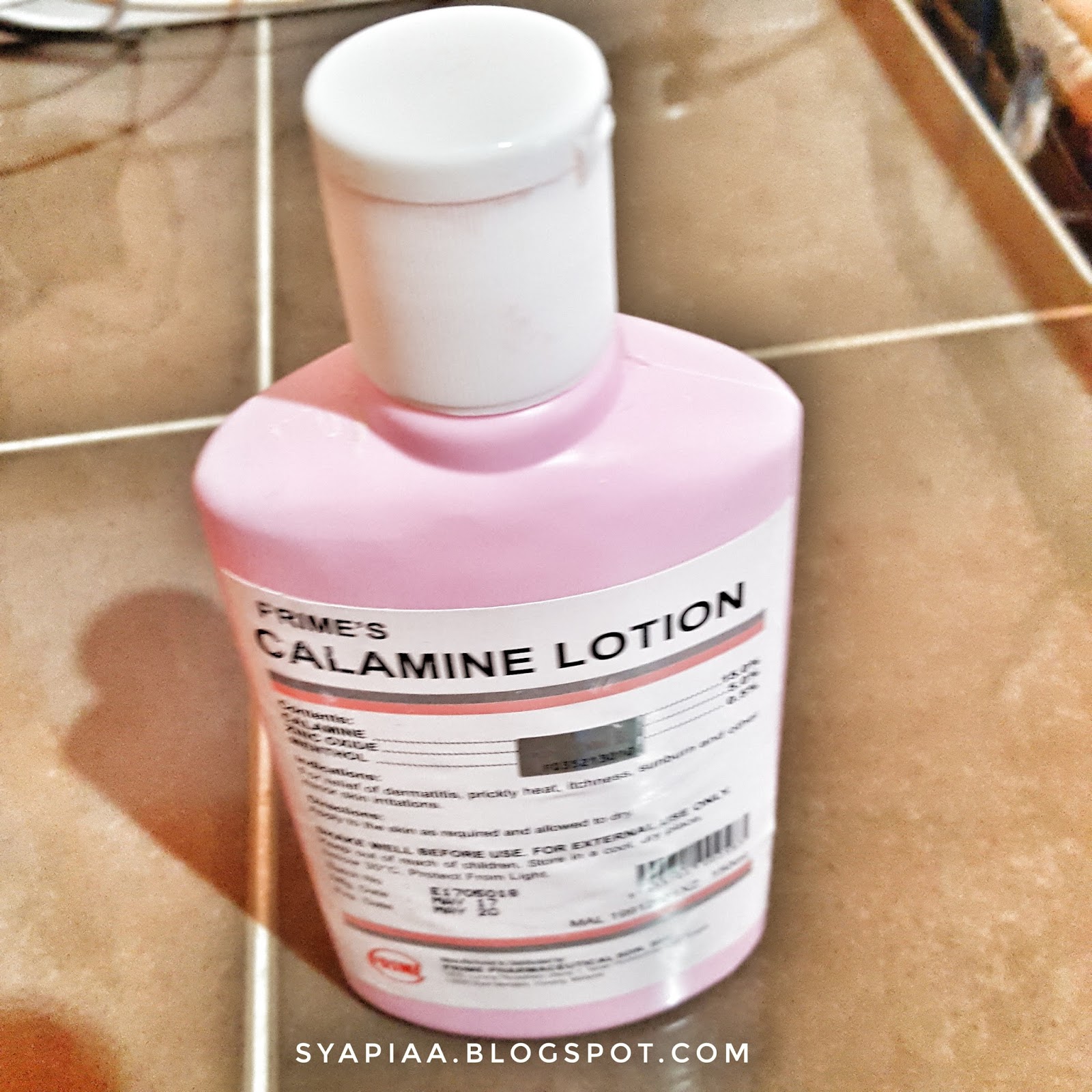 Ibuzahra Journey Tips Untuk Demam Campak atau Chicken Pox.