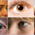 If You See These Unusual Things In Your Eyes, Better See Your Doctor Before It's Too Late
