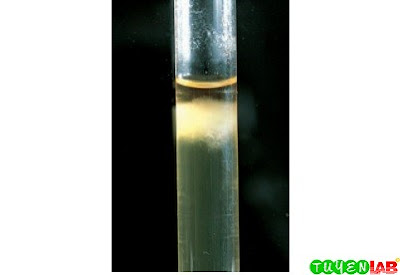 Yeast growing in the microaerophilic area of thioglycollate. Yeast growing in the microaerophilic area of thioglycollate.