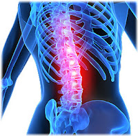 Causes of Back Pain and Relif for Healthy Lifestyle