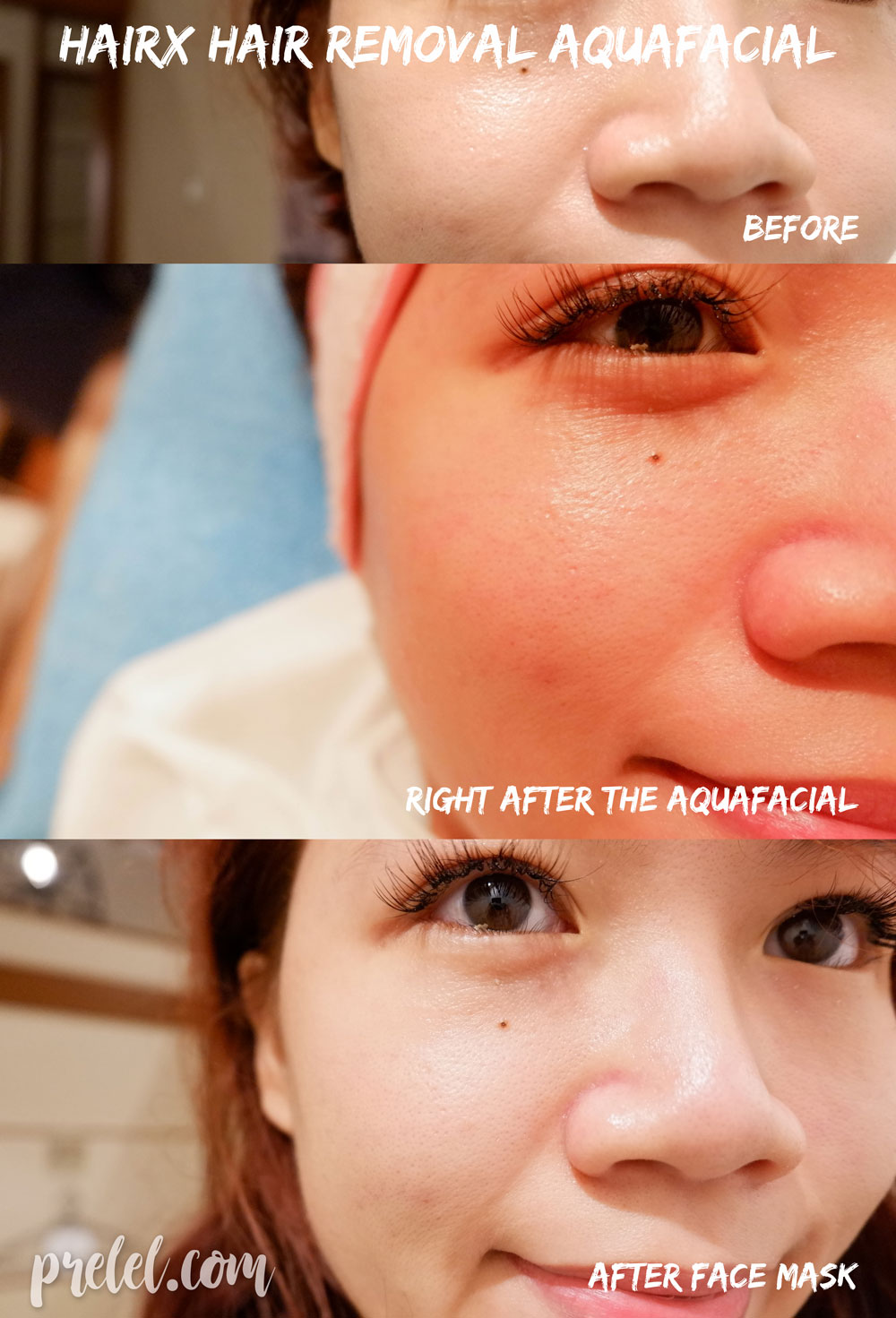 Skin Treatments With Instant Whitening And Glowing Results At