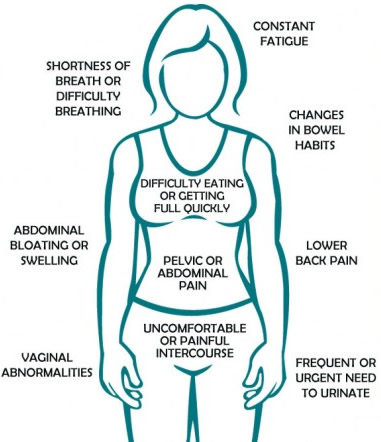 Symptoms of ovarian cancer