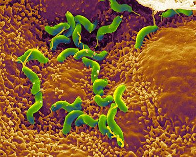 como se llama la bacteria que produce la gastritis