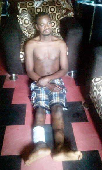 toyobo leg amputation toyobo leg amputation