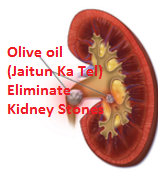 Olive oil (Jaitun Ka Tel)  Eliminate Kidney Stones