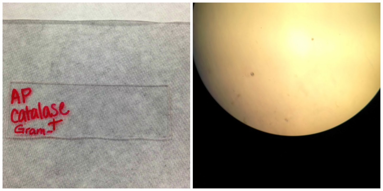 i-saw-that-going-differently-in-my-mind-microbiology-unknown-project