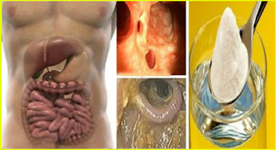 48 Hour Weekend Liver, Kidney and Colon Detox that Will Remove All Toxins and Fat from Your Body