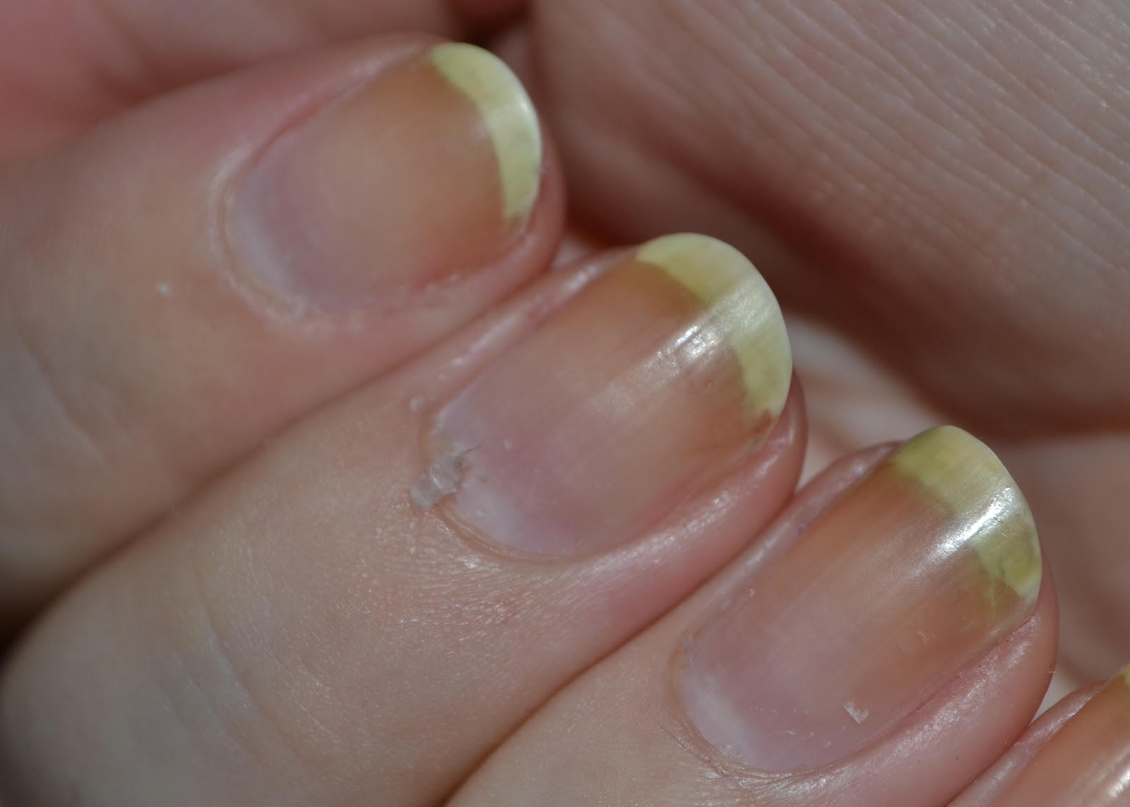 Hap Hap Happy Hands: Nail Care: Cuticle Remover