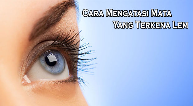 Cara Mengatasi Mata Yang Terkena Lem Cara Mengatasi Mata Yang Terkena Lem