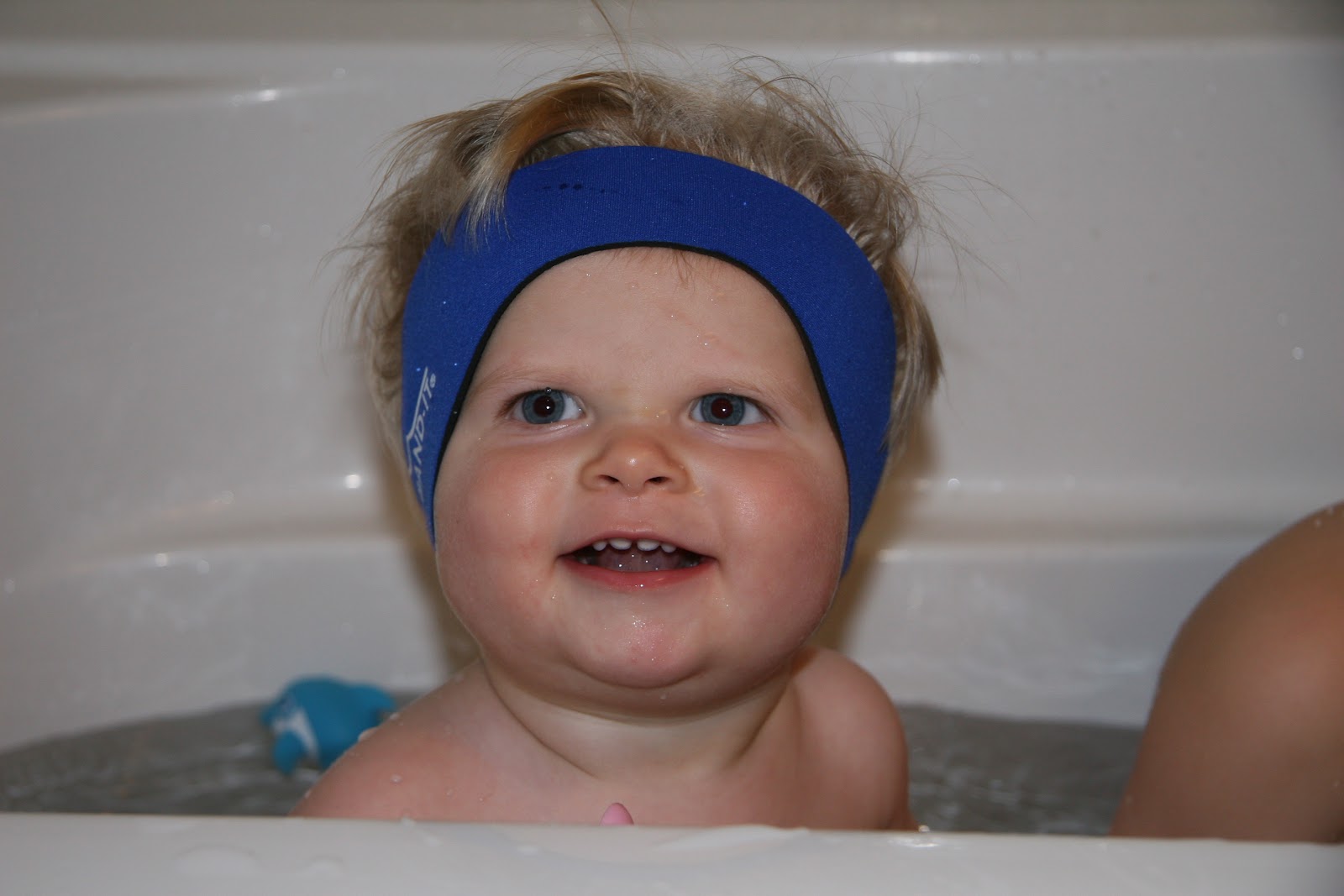 The Gonsalves Family So what does an ear tube look like anyway?