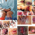 Wasir/Ambeien Alami Selain Propolis Melia Nature thumbnail