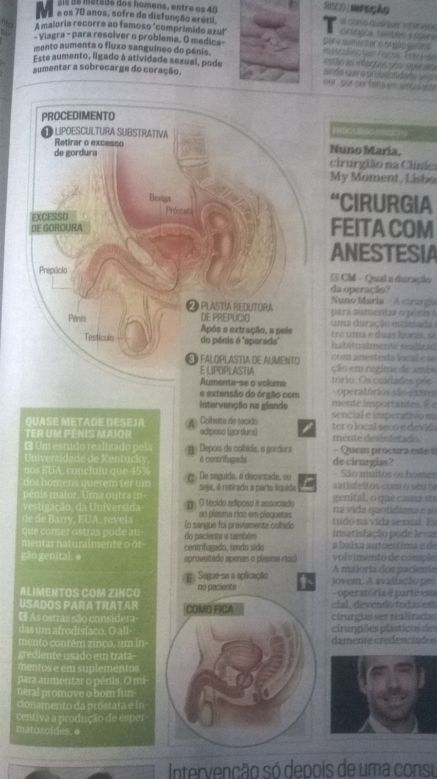 alimentos bom para prostata