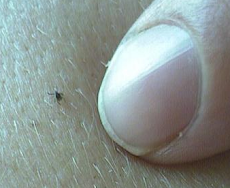 Tick Pic