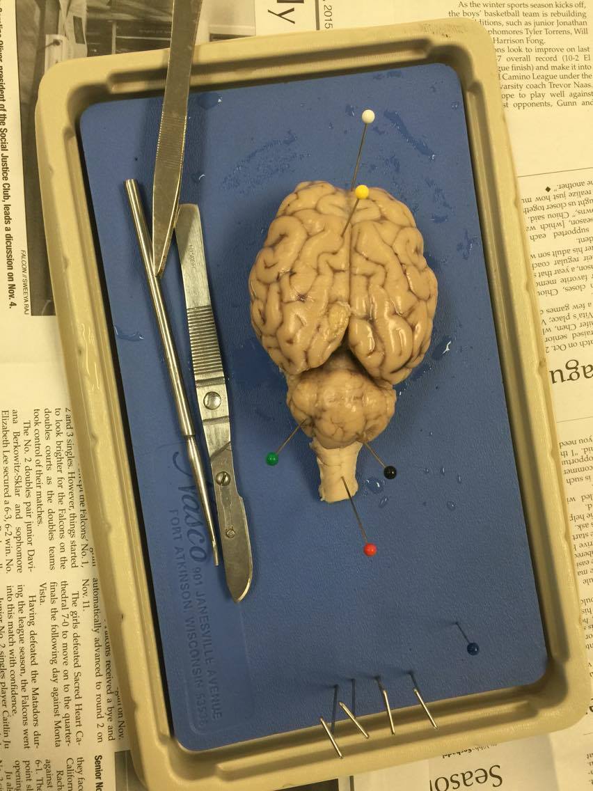 The Best of Anatomy Brain Dissection Anaylsis