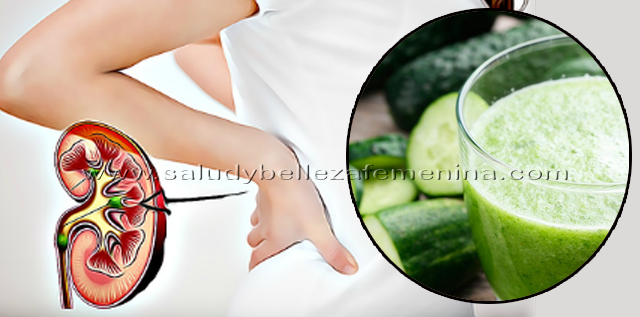 Dieta para eliminar arenilla rinones