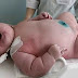 Australia: 600-Pound Woman Gives Birth to 40-Pound Baby