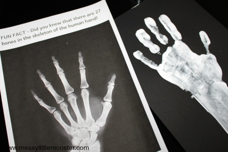 hand x ray craft for kids - human skeleton activities