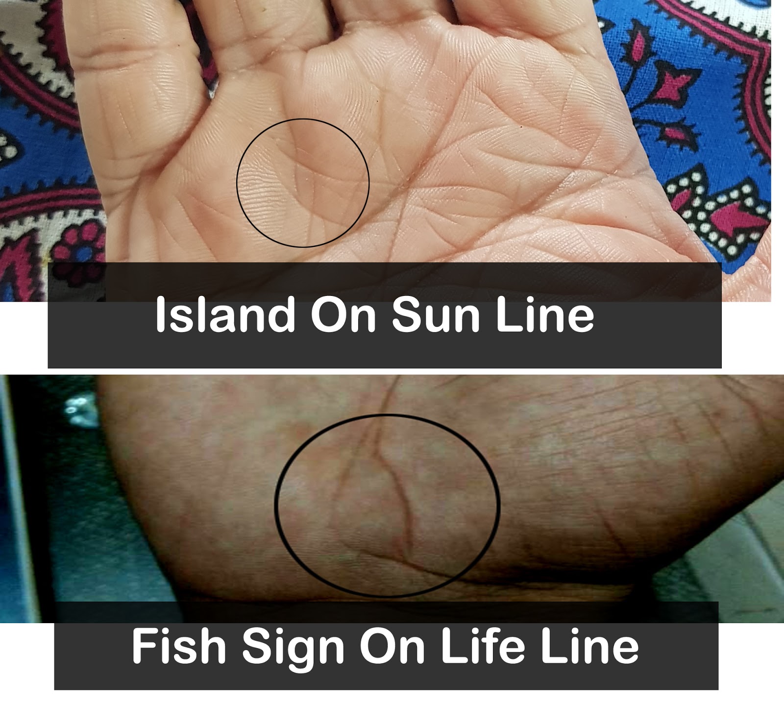 How To Differentiate Between Island on Sun Line And Fish Sign On Sun