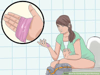 Obat Keluar Nanah Yang Aman Dan Ampuh Pada Lubang Vagina Obat Keluar Nanah Yang Aman Dan Ampuh Pada Lubang Vagina