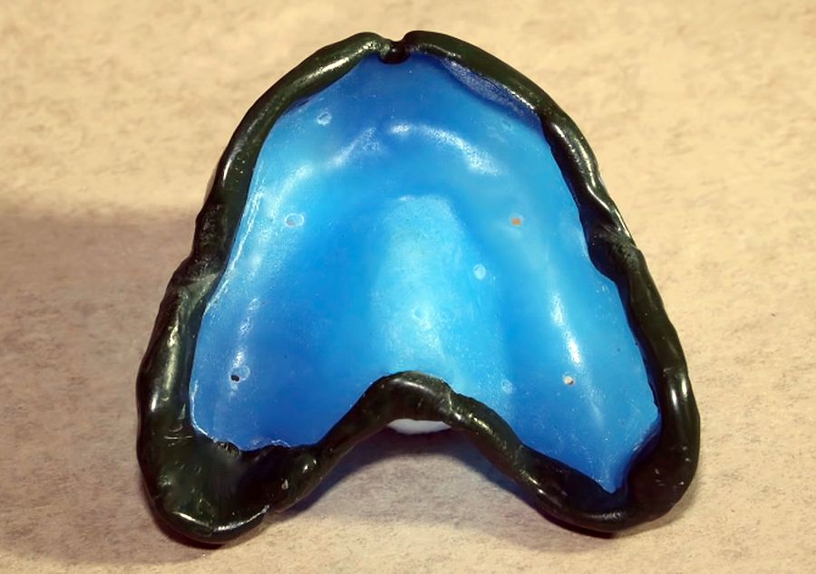 PROSTHODONTICS Border Molding for Complete Dentures OdontoTv