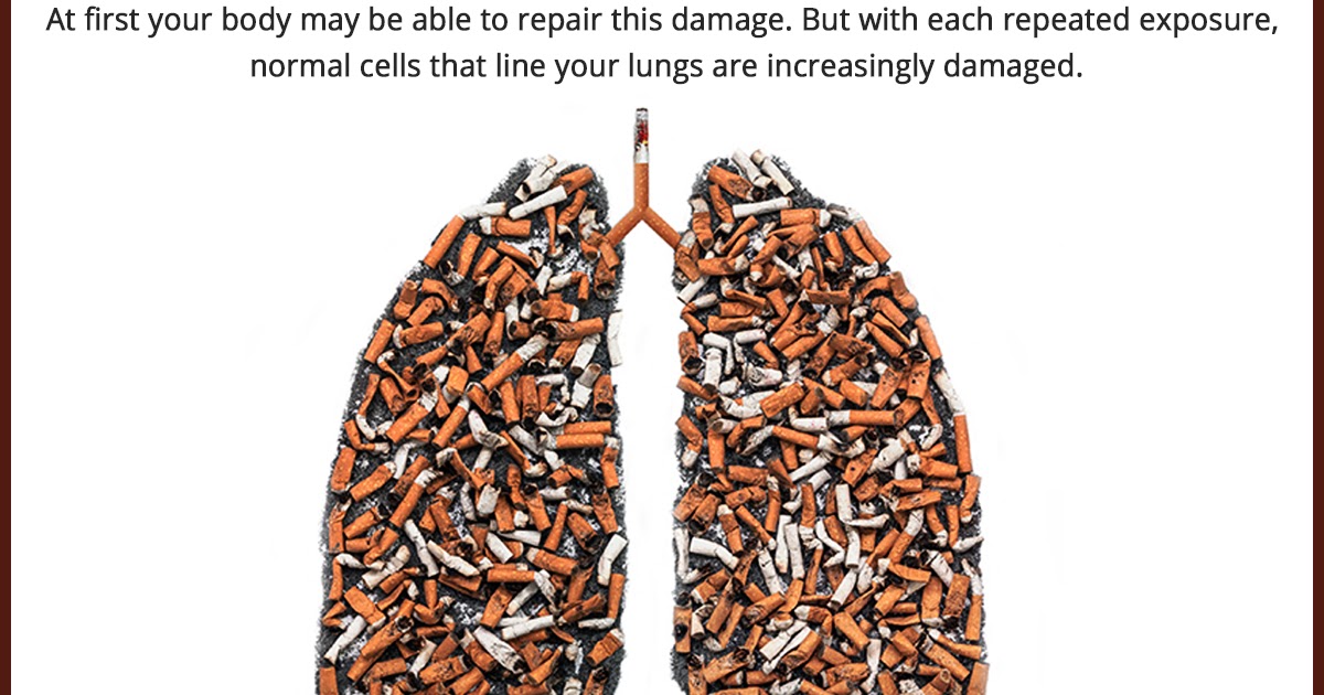 Queen's NRI Hospital How does Smoking Cause Lung Cancer?