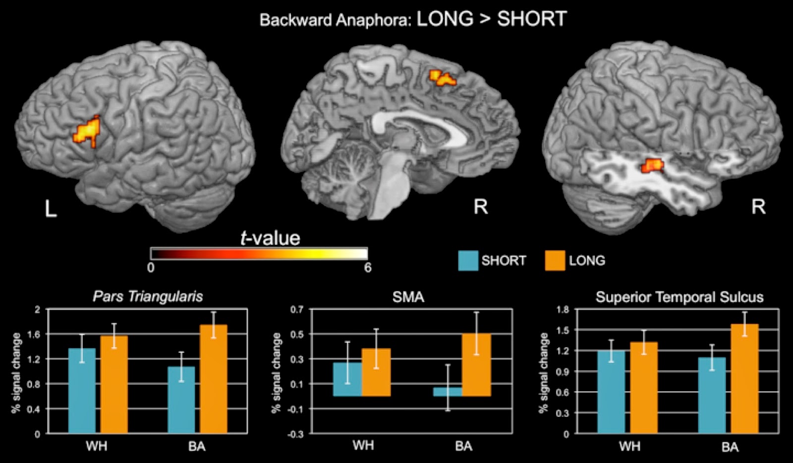 Talking Brains: Broca's area doesn't care what you do (syntactically): it  cares how you do it (actively)