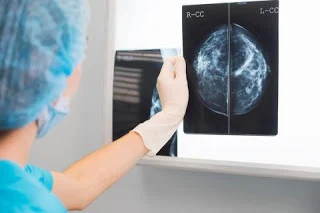  FDA pone cambios en las pautas de mamografía por primera vez