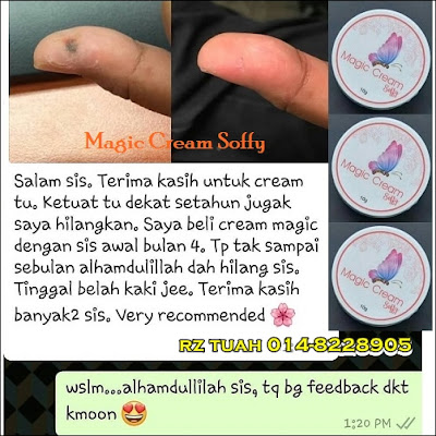 magic cream soffy buang tahi lalat ketuat kutil bintil minyak