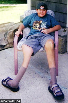 man with largest feet