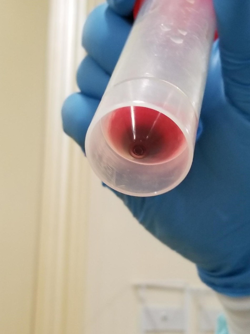 our parkinsons place miami doctor pioneers innovative stem cell center for regenerative medicine miami
