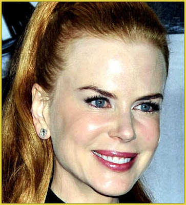 Nicole Kidman Plastic Surgery Before and After Botox, Lips and Breast