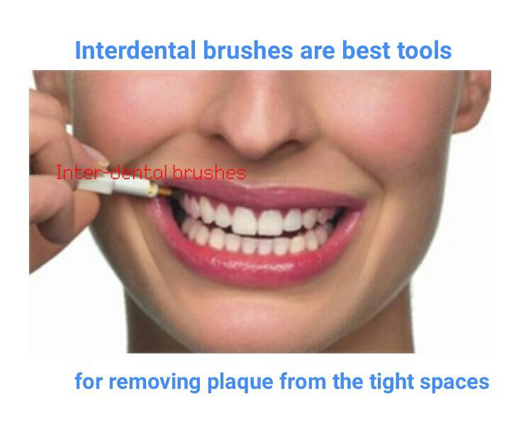 4 Ways To Use Interdental Brushes To Clean Inbetween Teeth