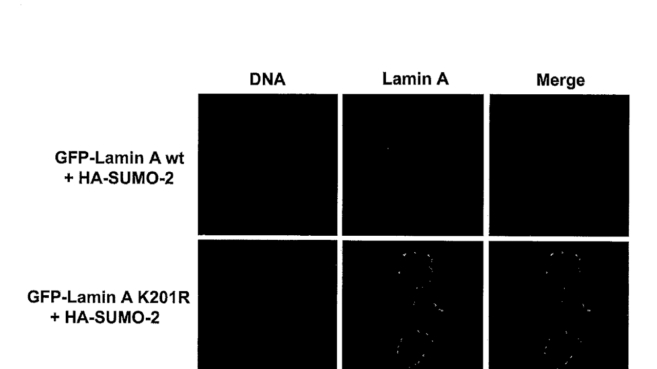 LMNA - Lamin A Protein
