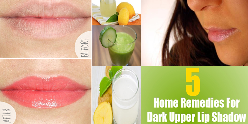 5 Top Home Remedies For Dark Upper Lip Shadow B And G Fashion