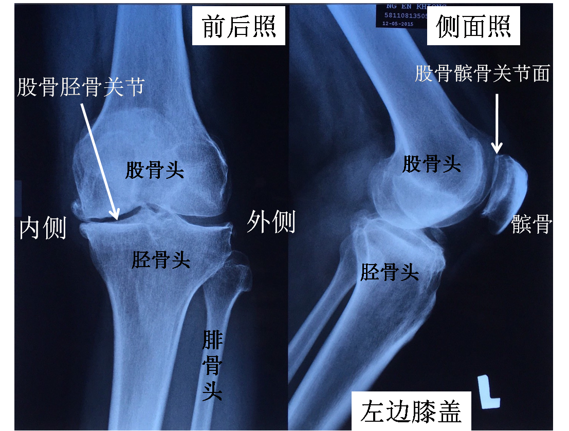 人体膝盖关节骨骼图片素材-编号27658082-图行天下