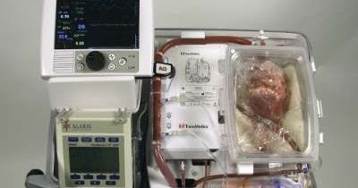 Alat Penyimpan Jantung - REFERENSI BEBAS