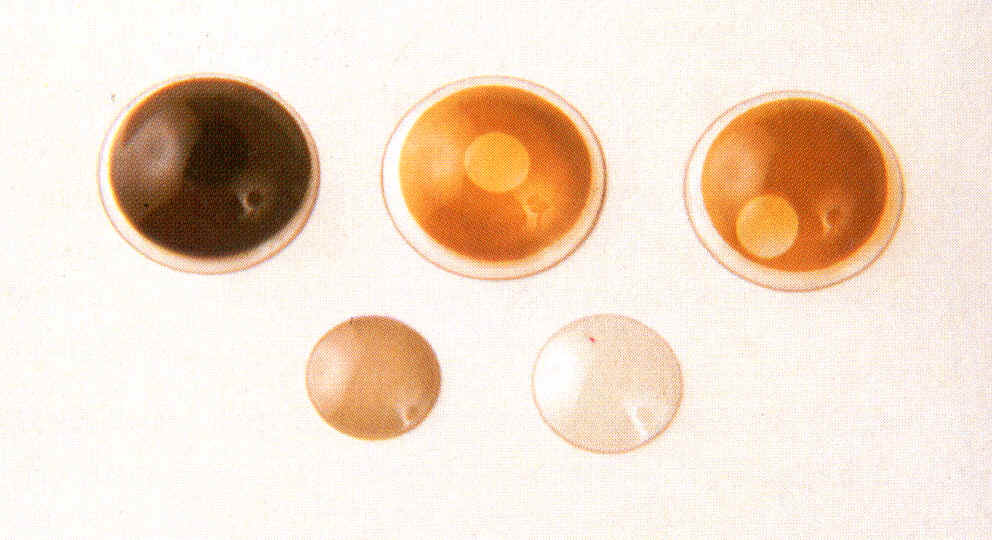 HISTORY History of Contact Lenses