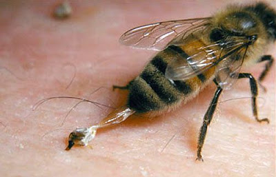  Rasa sakit akhir sengatan lebah memang menyakitkan 8 Cara Efektif Mengobati Sengatan Lebah (Tawon)