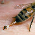 8 Cara Efektif Mengobati Sengatan Lebah (Tawon)