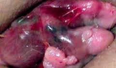 Foto Harga Obat Wasir Ardium di Apotek Surabaya