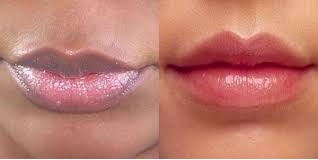 Begini Cara Membuat Bibir Hitam Menjadi Merah Merona, Silahkan Share..!!