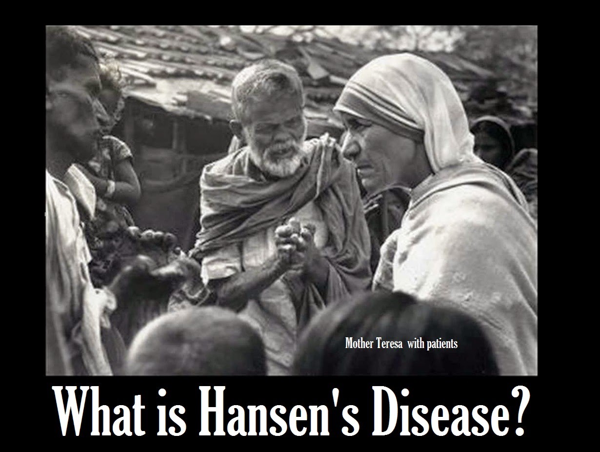 What is Hansen's Disease? SkinnyZine
