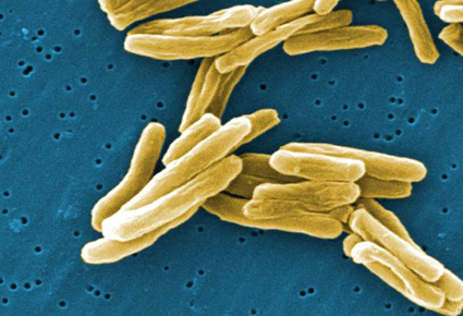 Tuberculosis Day Φυματίωση
