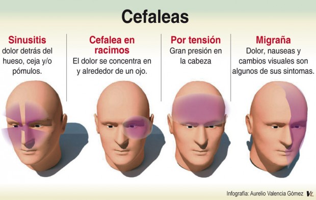 Los cuatro tipos de dolores de cabeza